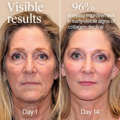 The OlaveraMD Anti-Aging Serum